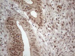 IRS1 Monoclonal Antibody (OTI9E11), TrueMAB , OriGene 100 &mu;L; Unconjugated:Antibodies,