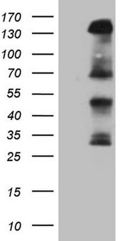 IRS1 Monoclonal Antibody (OTI9E11), TrueMAB , OriGene 100 &mu;L; Unconjugated:Antibodies,