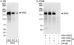 IRS2 Rabbit anti-Human, Polyclonal, Bethyl Laboratories 100 &mu;L; Unconjugated:Antibodies,