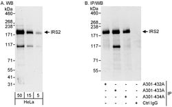 IRS2 Rabbit anti-Human, Polyclonal, Bethyl Laboratories 100 &mu;l; Unlabeled:Antibodies,