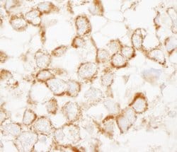 IRS2 Polyclonal Antibody, Bethyl Laboratories:Antibodies:Primary Antibodies