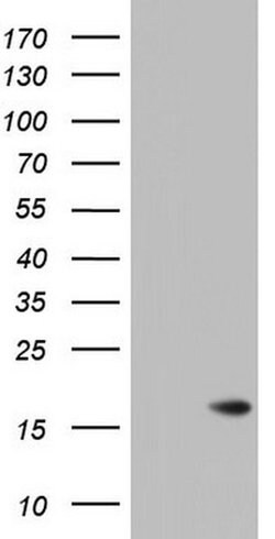 ISCU Monoclonal Antibody (OTI8H2), TrueMAB , OriGene:Antibodies:Primary