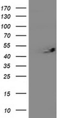 ITFG2 Monoclonal Antibody (OTI 2H5), TrueMAB , OriGene 30 &mu;L; Unconjugated:Antibodies,