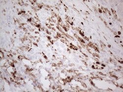 ITGAM Monoclonal Antibody (OTI12C10), TrueMAB , OriGene 100 &mu;L; Unconjugated:Anticuerpos