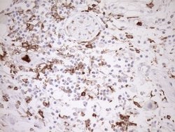 ITGAM Mouse anti-Human, Clone: OTI2D11, lyophilized, TrueMAB 100 &mu;g;