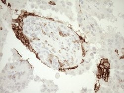 ITGAM Mouse anti-Human, Clone: OTI2D11, lyophilized, TrueMAB 100 &mu;g;