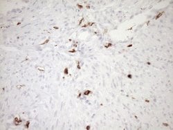 ITGAM Mouse anti-Human, Clone: OTI2D11, lyophilized, TrueMAB 100 &mu;g;