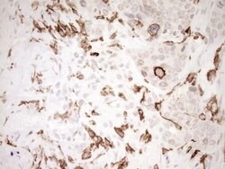 ITGAM Mouse anti-Human, Clone: OTI2D11, lyophilized, TrueMAB 100 &mu;g;