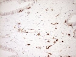 ITGAM Mouse anti-Human, Clone: OTI2D11, lyophilized, TrueMAB 100 &mu;g;