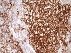 ITGAM Mouse anti-Human, Clone: OTI2D11, lyophilized, TrueMAB 100 &mu;g;