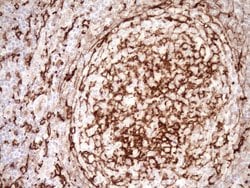 ITGAM Mouse anti-Human, Clone: OTI2D11, lyophilized, TrueMAB 100 &mu;g;