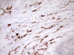 ITGAM Mouse anti-Human, Clone: OTI2D11, lyophilized, TrueMAB 100 &mu;g;