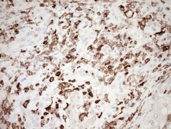 ITGAM Mouse anti-Human, Clone: OTI2D11, lyophilized, TrueMAB 100 &mu;g;