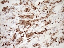 ITGAM Mouse anti-Human, Clone: OTI2D11, lyophilized, TrueMAB 100 &mu;g;