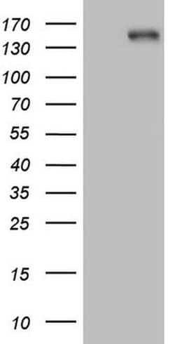 ITGAM Monoclonal Antibody (OTI12C10), TrueMAB , OriGene 100 &mu;L; Unconjugated:Anticuerpos