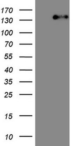 ITGAM Mouse anti-Human, Clone: OTI2D11, TrueMAB , Origene 30 &mu;L; Unconjugated:Antibodies,