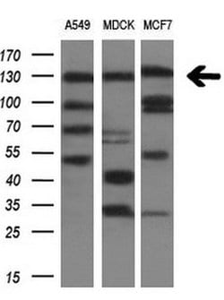 ITGAM Mouse anti-Human, Clone: OTI2D11, lyophilized, TrueMAB 100 &mu;g;