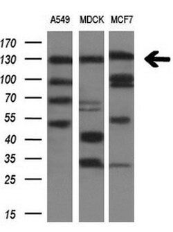 ITGAM Mouse anti-Human, Clone: OTI2D11, TrueMAB , Origene 30 &mu;L; Unconjugated:Antibodies,