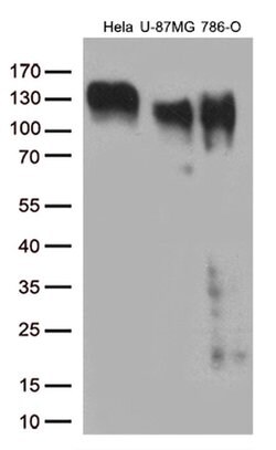 ITGB1 Monoclonal Antibody (OTI9B5), TrueMAB , OriGene 100 &mu;L; Unconjugated:Antibodies,