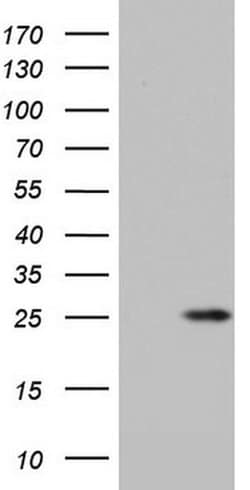 ITGB1BP1 Monoclonal Antibody (OTI1D10), TrueMAB , OriGene:Antibodies:Primary