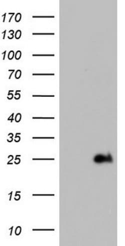 ITGB1BP1 Mouse anti-Human, Clone: OTI3B3, lyophilized, TrueMAB 100 &mu;g;