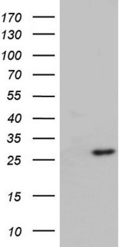 ITGB1BP1 Mouse anti-Human, Clone: OTI7E8, lyophilized, TrueMAB 100 &mu;g;