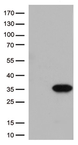 ITGB1BP3 Mouse anti-Human, Clone: OTI1A12, lyophilized, TrueMAB 100 &mu;g;