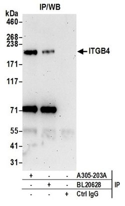 ITGB4/CD104/Integrin beta-4 Rabbit anti-Human, Polyclonal, Bethyl Laboratories