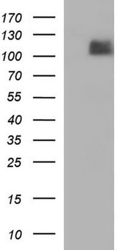 ITGB6 Monoclonal Antibody (OTI1D2), TrueMAB , OriGene 100 &mu;L; Unconjugated:Antibodies,