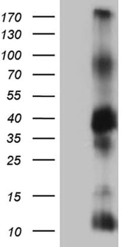 ITM2A Monoclonal Antibody (OTI2D5), TrueMAB , OriGene 100 &mu;L; Unconjugated:Antibodies,