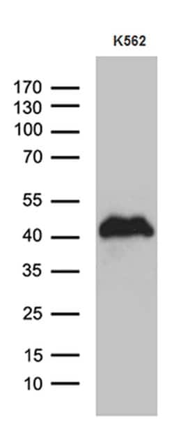 ITM2A Monoclonal Antibody (OTI2D5), TrueMAB , OriGene 100 &mu;L; Unconjugated:Antibodies,