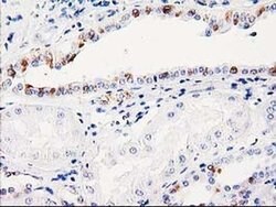 ITM2B Monoclonal Antibody (OTI1C11), TrueMAB , OriGene 30 &mu;L; Unconjugated:Antibodies,