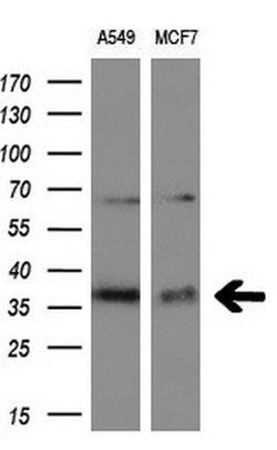 ITM2B Monoclonal Antibody (OTI1C11), TrueMAB , OriGene 30 &mu;L; Unconjugated:Antibodies,