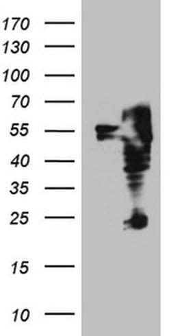 ITPK1 Monoclonal Antibody (OTI1F5), TrueMAB , OriGene 100 &mu;L; Unconjugated:Antibodies,