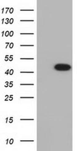 IVD Monoclonal Antibody (OTI5A11), TrueMAB , OriGene 100 &mu;L; Unconjugated:Antibodies,