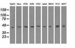 IVD Monoclonal Antibody (OTI5A11), TrueMAB , OriGene 100 &mu;L; Unconjugated:Antibodies,