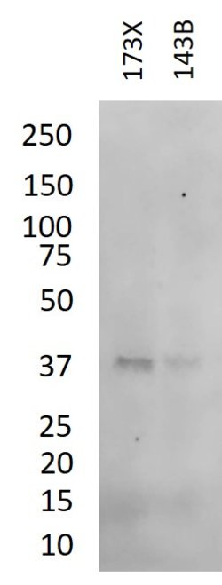 Invitrogen IkB alpha Monoclonal Antibody (6A920) 100 &mu;g; Unconjugated:Antibodies,