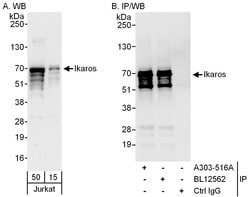 Ikaros Rabbit anti-Human, Polyclonal, Bethyl Laboratories 100 &mu;L; Unconjugated:Antibodies,