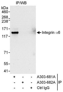 Integrin Alpha 6 Rabbit anti-Human, Polyclonal, Bethyl Laboratories 10