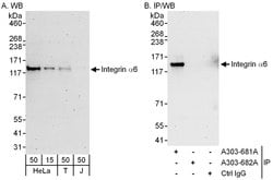 Integrin Alpha 6 Rabbit anti-Human, Polyclonal, Bethyl Laboratories 100