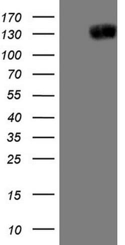 JAG1 Monoclonal Antibody (OTI3A10), TrueMAB , OriGene 100 &mu;L; Unconjugated:Antibodies,