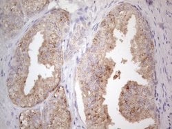 JAK2 Monoclonal Antibody (OTI7D12), TrueMAB , OriGene:Antibodies:Primary