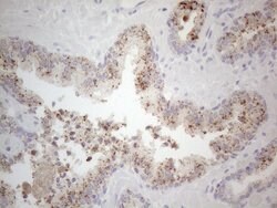 JAK2 Monoclonal Antibody (OTI7D12), TrueMAB , OriGene:Antibodies:Primary