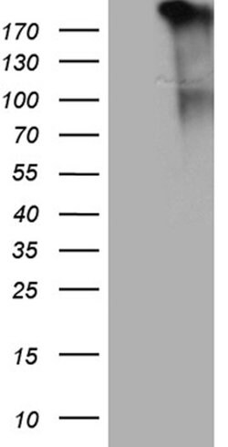 JAK2 Mouse anti-Human, Clone: OTI2F5, lyophilized, TrueMAB 100 &mu;g; Unconjugated:Antibodies,