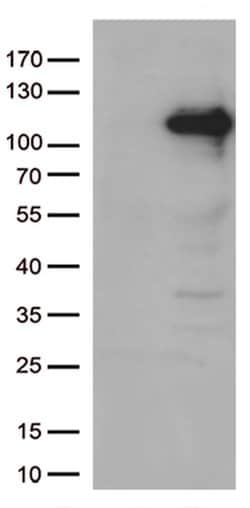 JAK3 Monoclonal Antibody (OTI1B4), TrueMAB , OriGene 100 &mu;L; Unconjugated:Antibodies,
