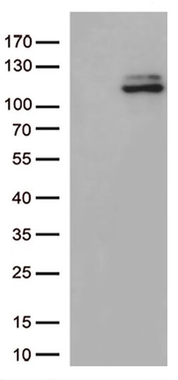 JAK3 Monoclonal Antibody (OTI2B4), TrueMAB , OriGene:Antibodies:Primary