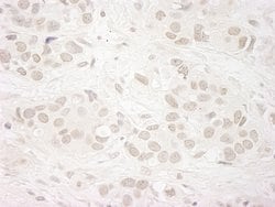 JARID1A/RBP2 Polyclonal Antibody, Bethyl Laboratories 100 &mu;L; Unconjugated:Antibodies,