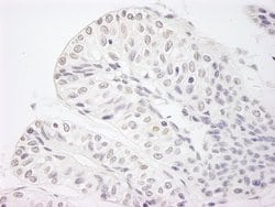 JARID1A/RBP2 Polyclonal Antibody, Bethyl Laboratories 100 &mu;L; Unconjugated:Antibodies,