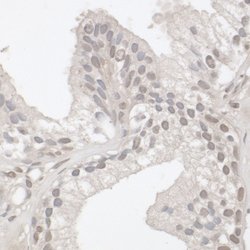 JARID1B Rabbit anti-Human, Mouse, Polyclonal, Bethyl Laboratories 100 &mu;l;