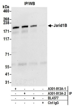 JARID1B Rabbit anti-Human, Mouse, Polyclonal, Bethyl Laboratories 100 &mu;l;